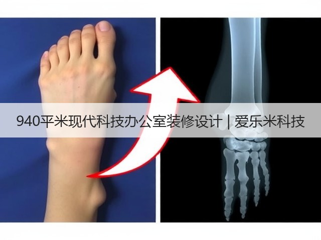 940平米现代科技办公室装修设计 | 爱乐米科技(图3)